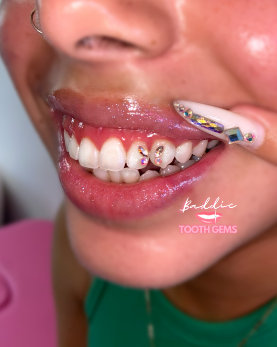 1:1 Combo Tooth Gem + Teeth Whitening Training & Certification