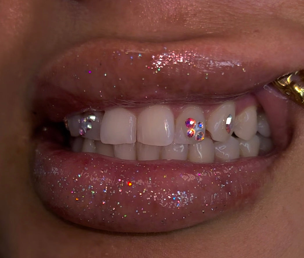Mini Tooth Gem Freestyle Set DEPOSIT