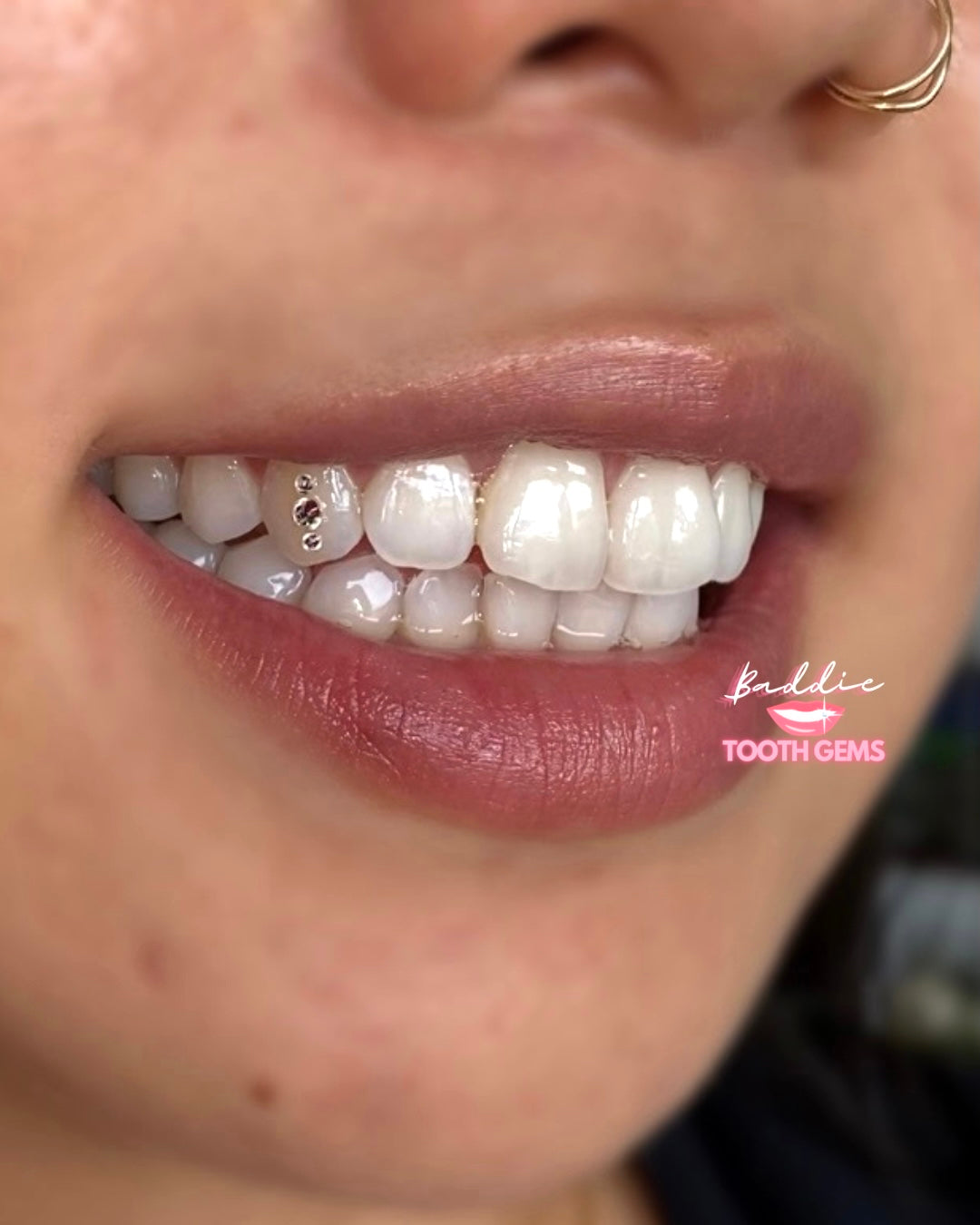 "Treat My Teeth" 2-in-1 Baddie Bundle | Teeth Whitening & Tooth Gem Appointment