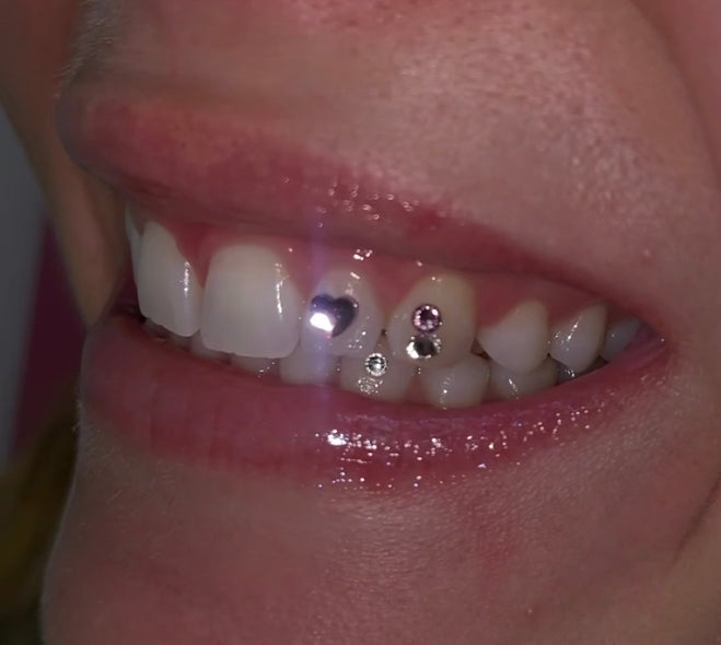 What to Know about Crystal or Diamond Teeth Gems
